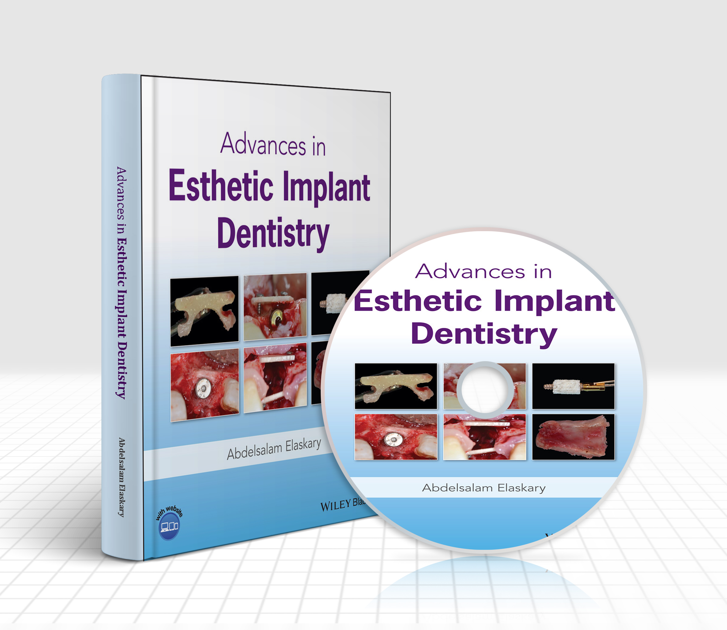 Advances In Esthetic Implant Dentistry 1st Edition, Kindle Edition