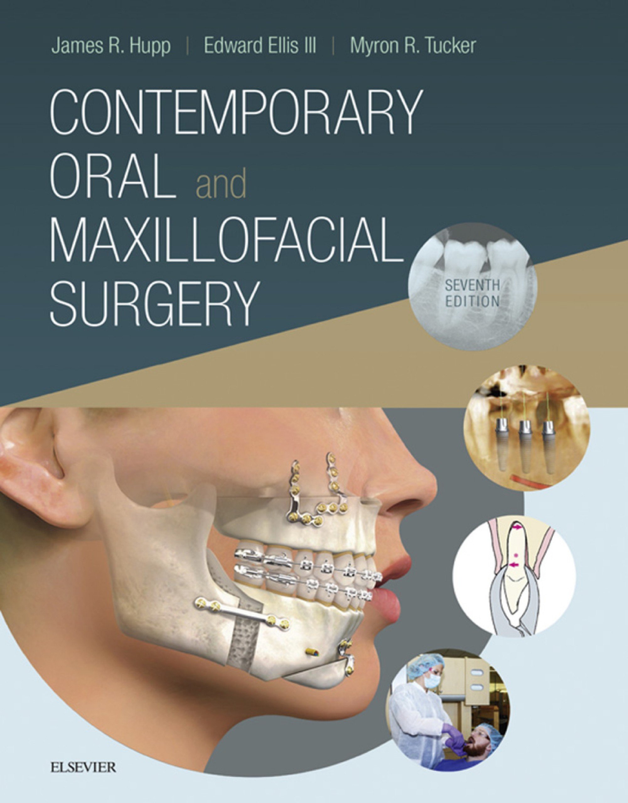 Contemporary Oral And Maxillofacial Surgery