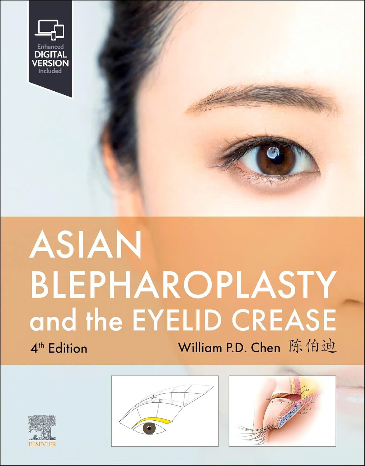 Asian Blepharoplasty and the Eyelid Crease 4th Edition,