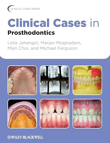 Clinical Cases in Prosthodontics 1st Edition