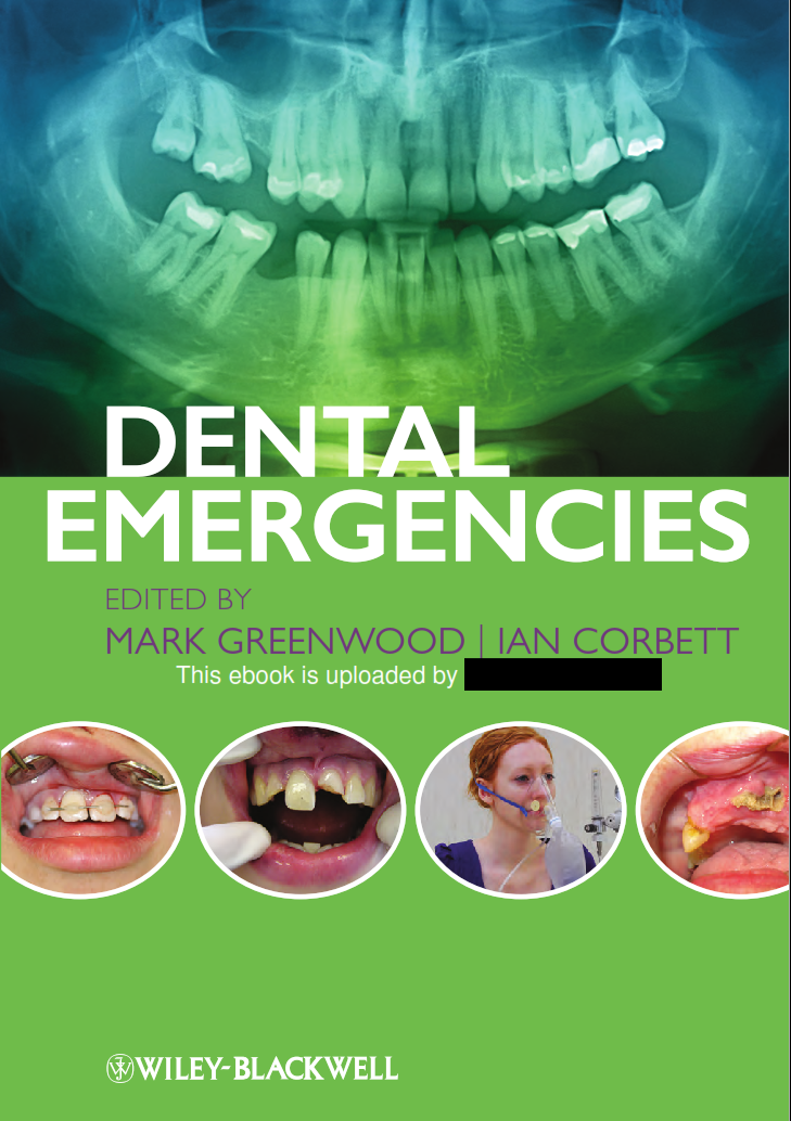 Dental Emergencies - Các trường hợp khẩn cấp về nha khoa