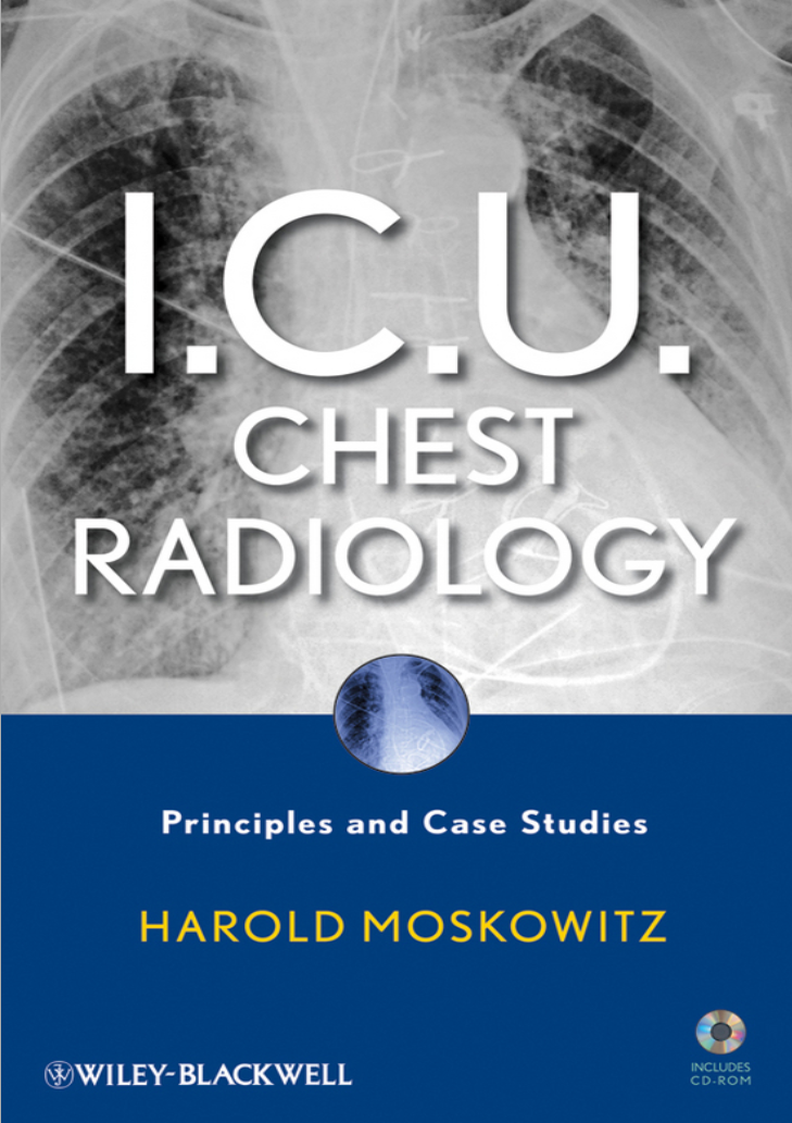 I.C.U. Chest Radiology - Nguyên lý và ca lâm sàng X quang ngực trong ICU