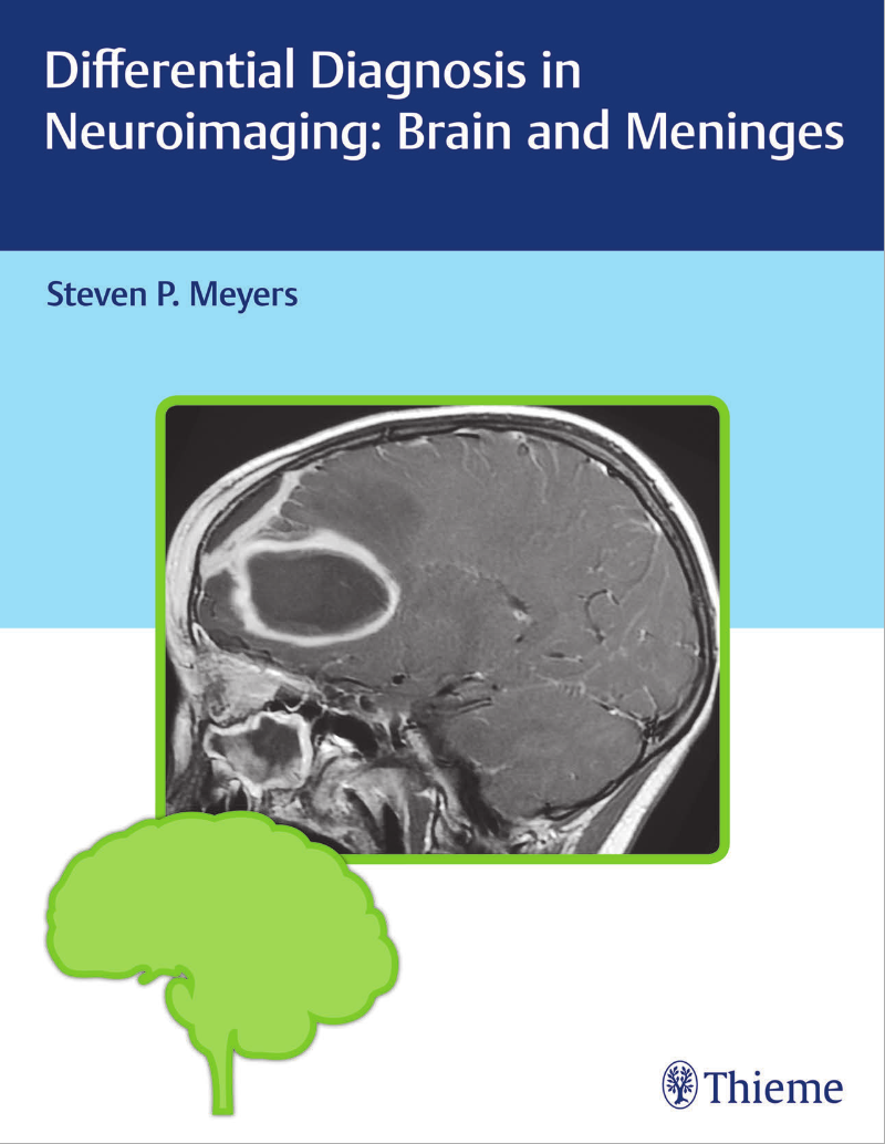 Differential Diagnosis in Neuroimaging - Chẩn đoán phân biệt trong hình ảnh thần kinh: Não và màng não