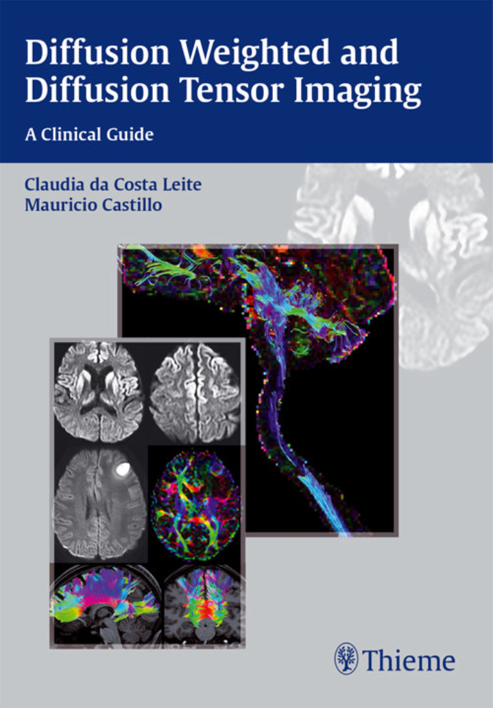 Diffusion Weighted and Diffusion Tensor Imaging - Hình ảnh căng thẳng có trọng số và khuếch tán khuếch tán