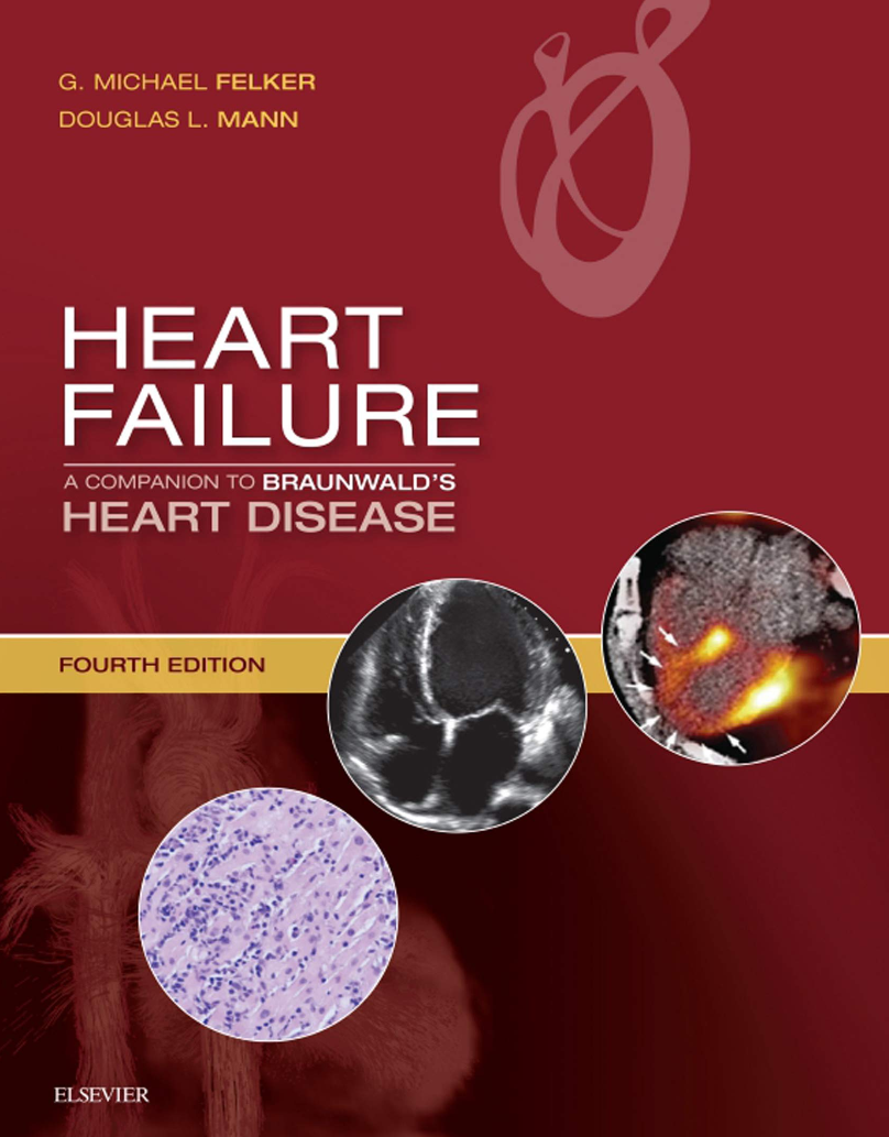 Heart Failure - Suy tim: Quản lý và điều trị