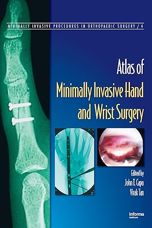 Atlas of Minimally Invasive Hand and Wrist Surgery (Minimally Invasive Procedures in Orthopaedic Surgery) 1st Edition