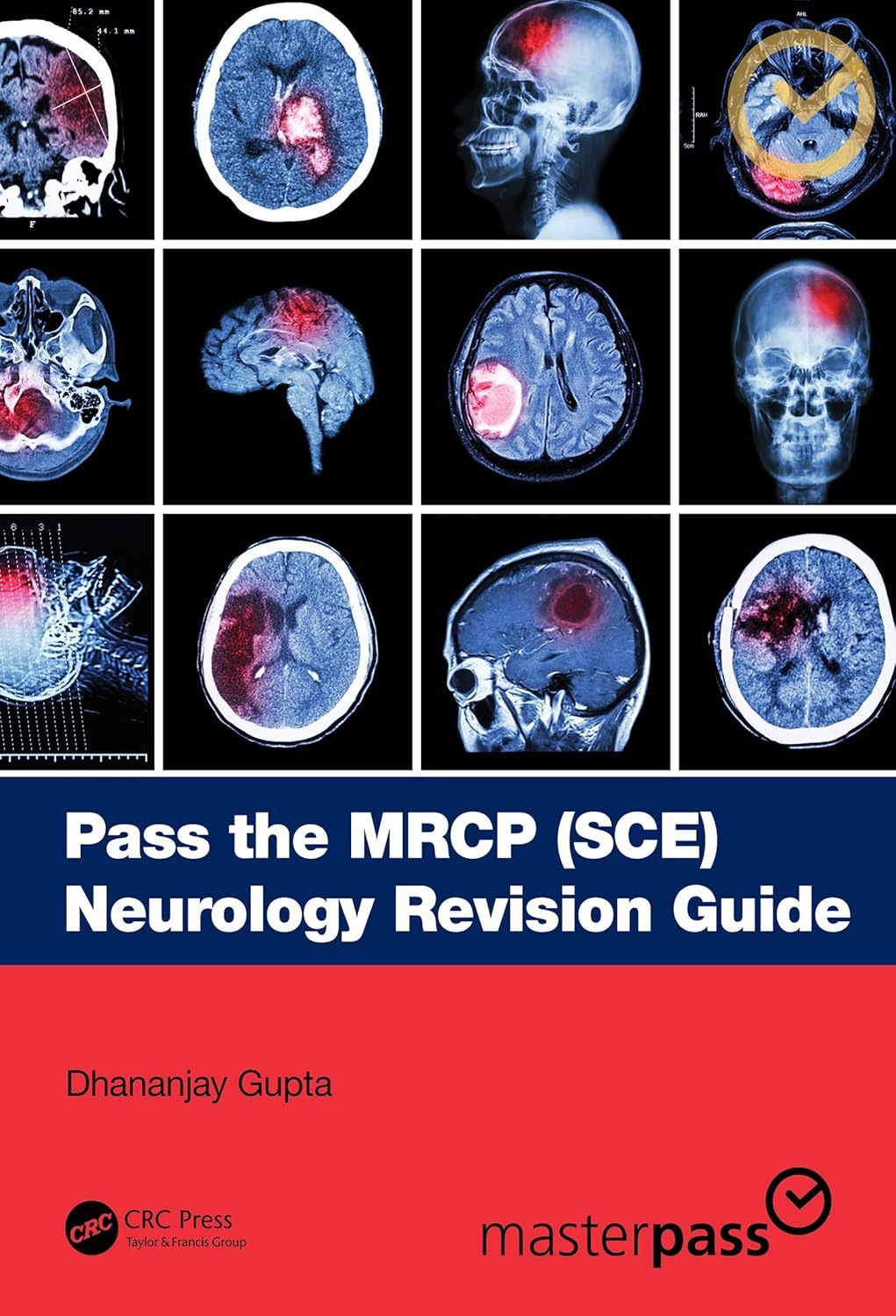 Pass the MRCP (SCE) Neurology Revision Guide (MasterPass) 1st Edition