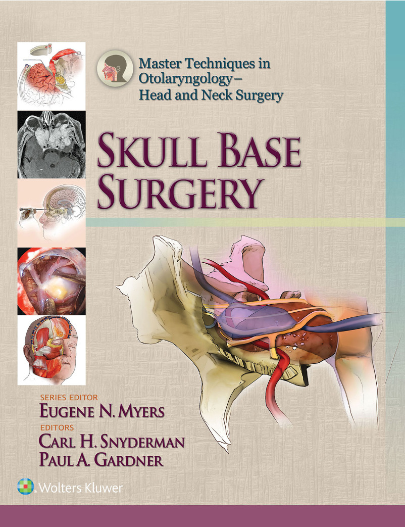 Master Techniques In Otolaryngology - Head And Neck Surgery: Skull Base ...