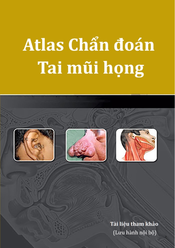 What is the diagnosis atlas for ear, nose, and throat conditions in Vietnamese?